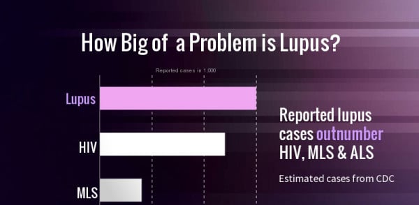 how is lupus contracted        <h3 class=